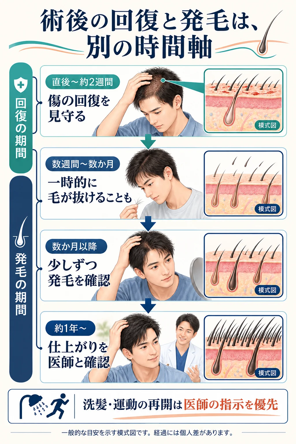 術後の傷の回復と、その後の一時的な脱毛・発毛・仕上がり確認を分けた経過の目安。