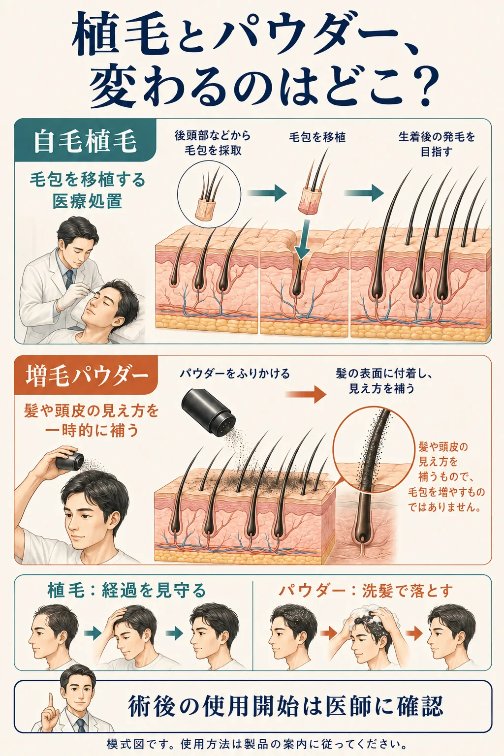 自毛植毛は毛包を移し、増毛パウダーは髪や頭皮の見え方を一時的に補う違いを示す図解。
