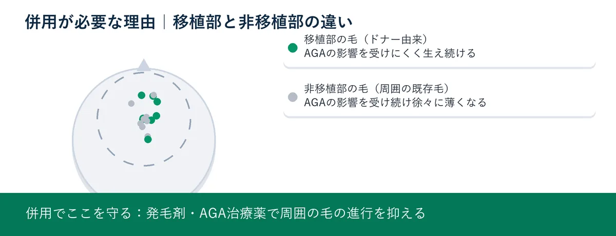 併用が必要な理由|移植部と非移植部の違いを示した頭部模式図